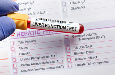 Blood tube test with requisition form for Liver Function Test LFT Profile. Blood sample tube for analysis of LFT Liver Function Test
