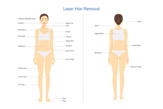 Popular points where Laser hair removal treatments on the people's body area. Illustration about laser clinic diagram for beauty treatment.