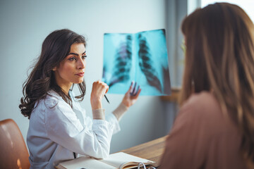 Female doctor showing x-rays to patient. Healthcare worker is discussing with woman. They are in hospital. Female Doctor explain x-ray chest result to illness female patient