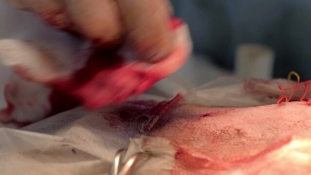 Two veterinarians perform abdominal surgery.Veterinarians perform surgery on a dog on the operating table at a local clinic.Dachshund in veterinary surgery.Veterinarians perform surgery on a dog.Blood