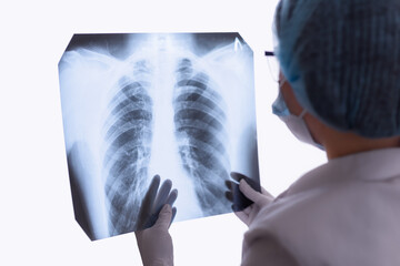 Doctor or radiologist examines a chest x-ray of a patient in a hospital. The concept of pulmonology. Control and monitoring of diseases of the lungs and respiratory organs.
