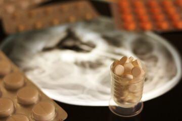 Pills for treatment and x-ray of a human head