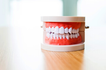 Single dental model on table