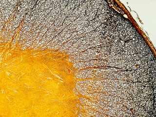 Spinal cord cross section under the microscope showing neurones and glial cells (nervous tissue) - optical microscope x100 magnification