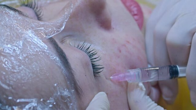 Beauty and injection concept. Cosmetology in the clinic. An experienced beautician wearing white gloves injects a subcutaneous injection with the necessary active ingredients into a woman's face for