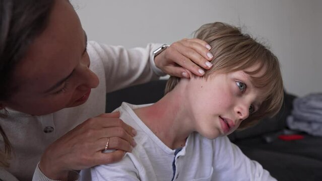 Symptoms of photodermatitis. Mom noticed a rash on the boy's neck. Improper nutrition. Worried mother discovers rash on baby's body. Body, health. Allergic reaction to sunlight