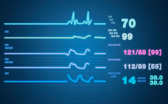 Patient monitor showing vital signs ECG and EKG. Vector illustration.