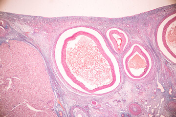 Obraz na płótnie Canvas Anatomy and Histological Ovary, Testis and Sperm human cells under microscope. 