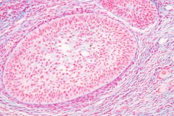 Fototapeta na wymiar Anatomy and Histological Ovary, Testis and Sperm human cells under microscope. 