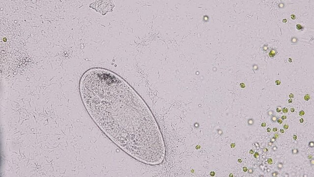 Paramecium caudatum is a genus of unicellular ciliated protozoan and Bacterium under the microscope.
