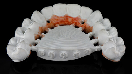 morphology of teeth dental prosthesis from zircon of the upper jaw on a black background © Dental Pro Content