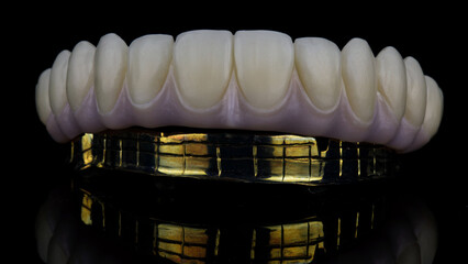 excellent angle of the dental prosthesis of the upper jaw made of zircon and a gilded beam, side view on a black background © Dental Pro Content