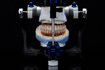 excellent dental photo of the articulator and two dental prostheses in the occlusion for accuracy...