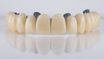 upper jaw prosthesis dental with beam on white background with reflection