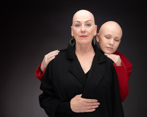 Two women with Alopecia pose together in studio.