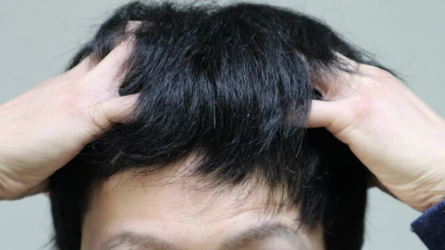 頭皮をマッサージする男性