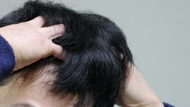 頭皮をマッサージする日本人男性