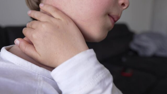 Allergic skin reaction on the childs neck and face - red rash. Symptoms of photodermatitis. Allergic reaction to sunlight