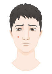 肌荒れ　肌トラブル　ニキビ　男性