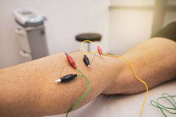 electroacupuncture with the needle connection machine used by the acupuncturist in men. Electrical...