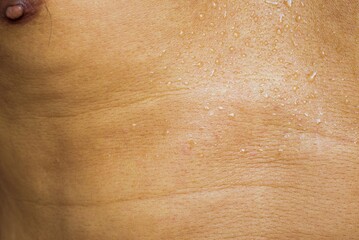 Fototapeta premium human skin water drop tan texture background