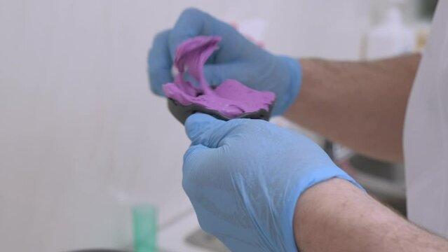 Doctor orthodontist in gloves holds a fingerprint for denture purple. Dental staff mix alginate for dental impression to make teeth working model. Healthcare and dentistry business