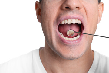Examining man's teeth and gums with mirror on white background, closeup
