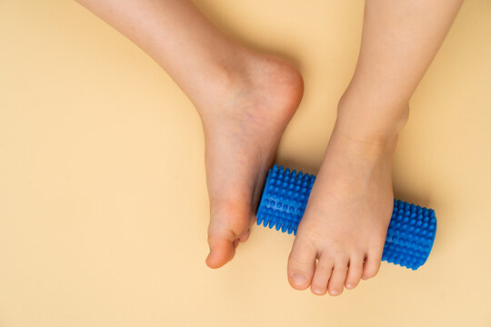 blue needle roller for massage and physiotherapy on a beige background with the image of a child's foot, the concept of prevention and treatment of hallux valgus