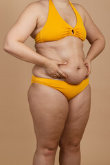 Cropped vertical image overweight fat naked woman, obesity, excess fat in yellow swimsuit. Adipose....