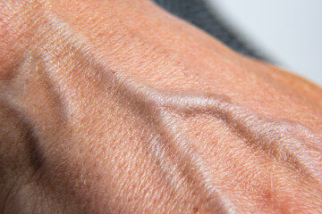 Macro of a hand back with protruding veins