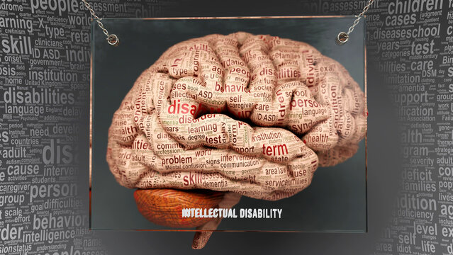 Intellectual Disability Anatomy - Its Causes And Effects Projected On A Human Brain Revealing Intellectual Disability Complexity And Relation To Human Mind. Concept Art, 3d Illustration