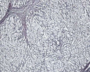 Human liver. Cirrhosis. Silver stain