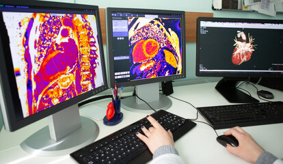 MRI CT Scanned image show on computer in DataCenter operation room.
