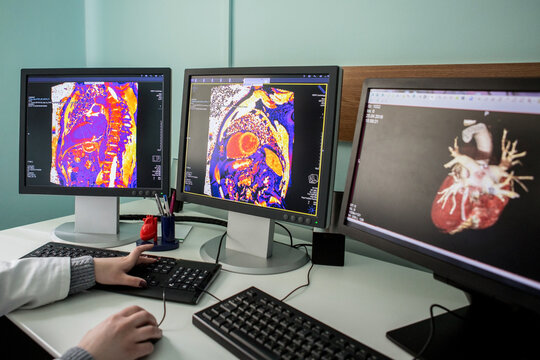 MRI CT Scanned image show on computer in DataCenter operation room.