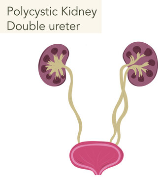 Kidney illustration disease nephrology ureter