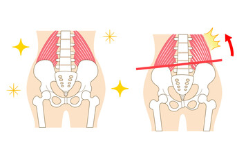 Left-right tilted pelvis and quadratus lumborum.