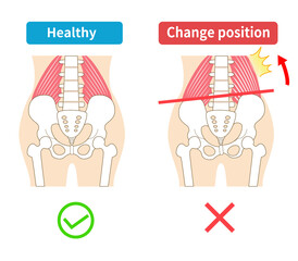 Left-right tilted pelvis and quadratus lumborum.