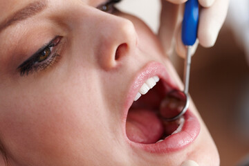 Oral checkup. Closeup of patients open mouth before oral checkup.