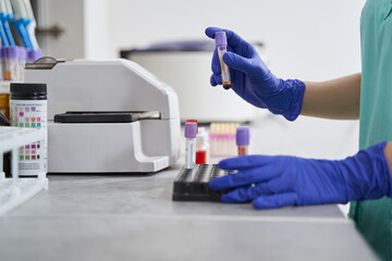 Close-up photo of doctor working in laboratory