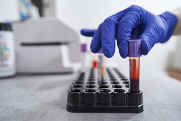Close-up photo of work in medical laboratory