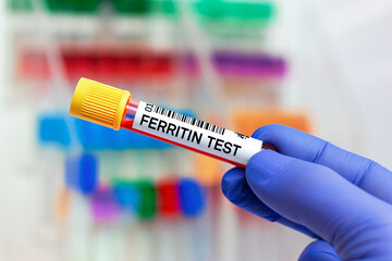 doctor with Blood tube for Ferritin test. Blood sample of patient for Ferritin test in laboratory