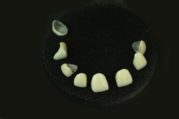 Dentures made of non-precious material and then baked with porcelain before the dentist puts them on the patient.