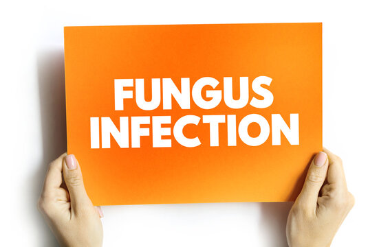 Fungus infection text quote on card, medical concept background