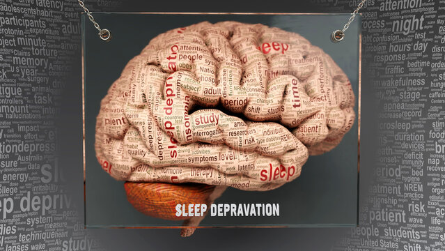 Sleep depravation anatomy - its causes and effects projected on a human brain revealing Sleep depravation complexity and relation to human mind. Concept art, 3d illustration