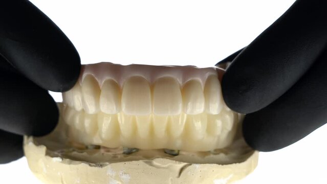 two dental prostheses of the upper and lower jaws made of zircon, showing chewing functions and the inner side of the prosthesis on a white background