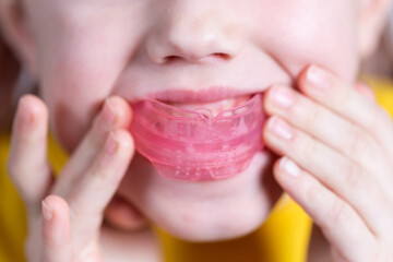 Six-year old caucasian girl shows myofunctional trainer in her mouth