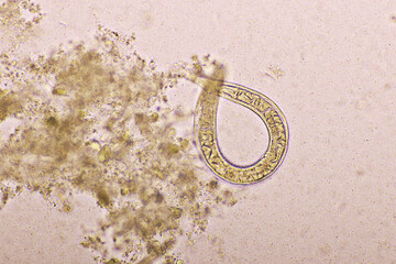 Strongyloides stercoralis or threadworm in human stool, analyze by microscope, original magnification 400x