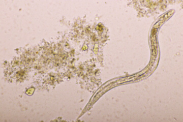Strongyloides stercoralis or threadworm in human stool, analyze by microscope, original...