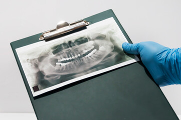 A 3D photograph of a patient is in the dentist's hand. The doctor examines him during the reception of the patient. Dental practice.