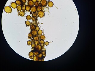 Arbuscular Mycorrhizal Fungi. Photomicrograph. Microscopic image of inactive root blade colonized...